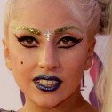 Lady Gaga será operada porque no puede caminar